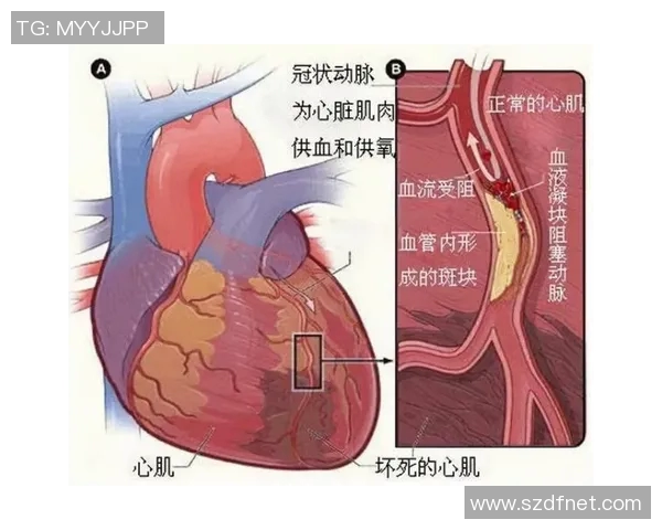 西班牙足球明星突发心肌梗死引发健康警示运动员需关注心脏健康问题